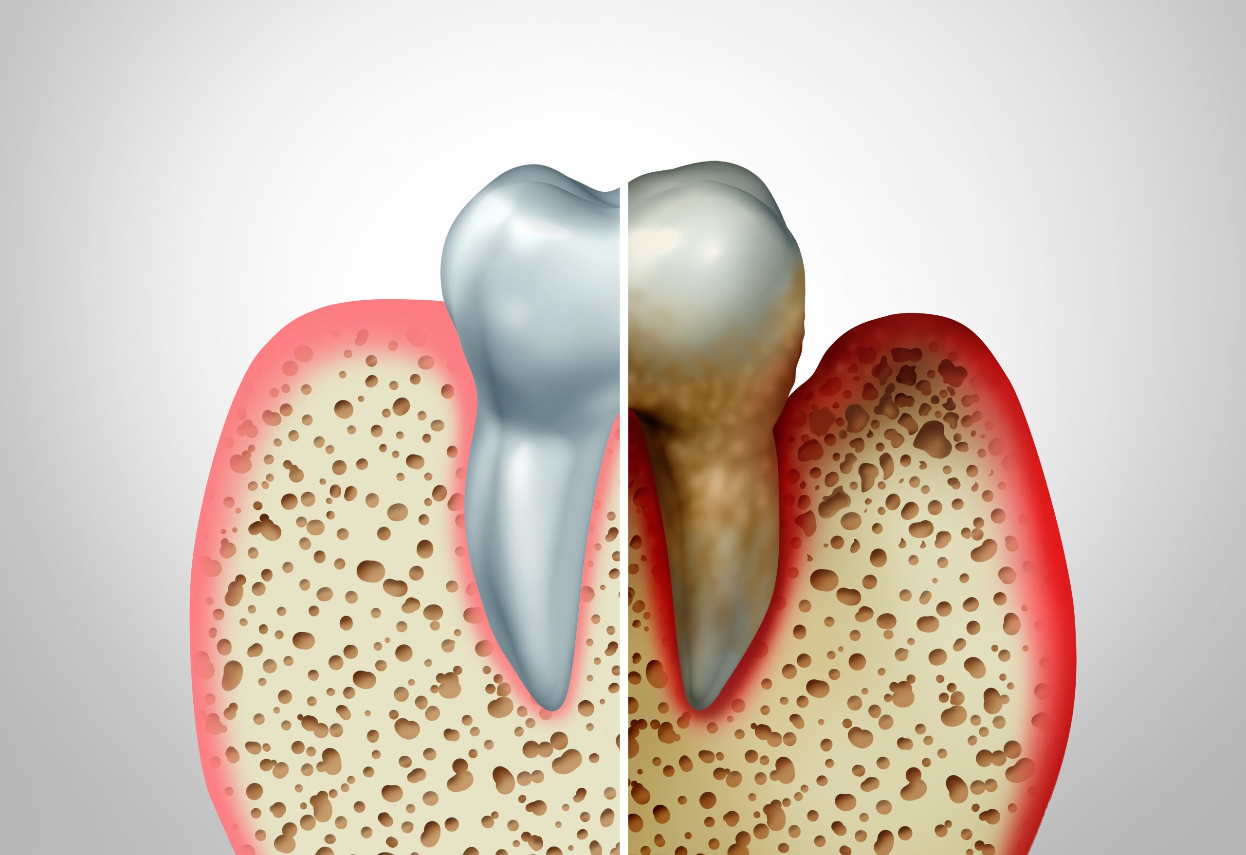 Periodontics